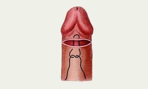 glans of the penis